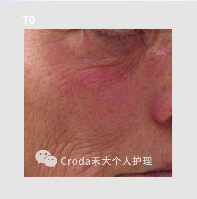 根源抗老，革新科技首度揭秘！
