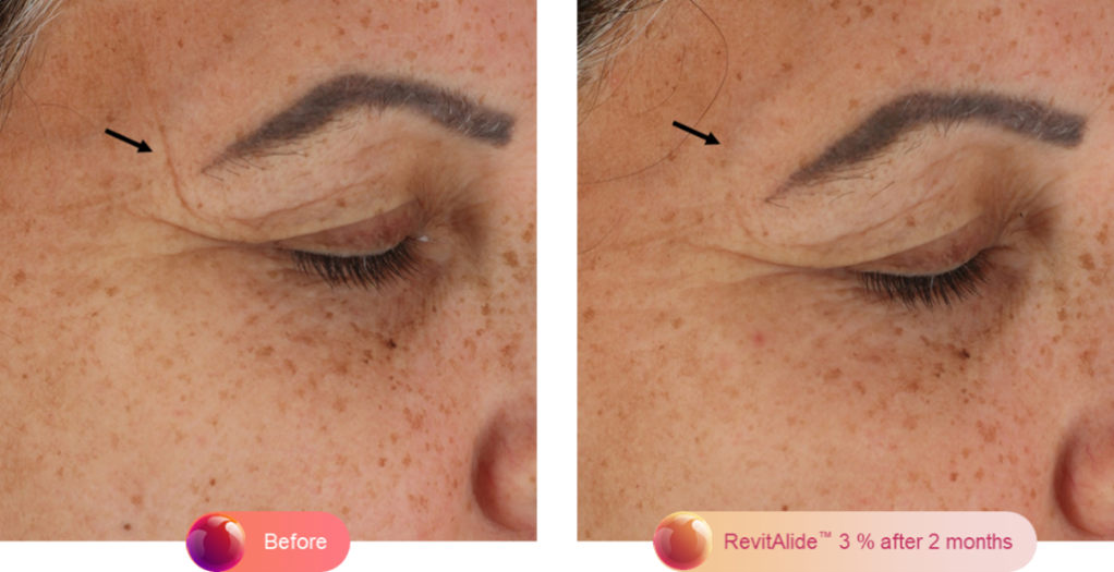revitalide comparison